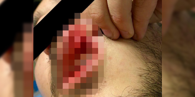 Sağlık çalışanı hasta yakını tarafından darp edildi