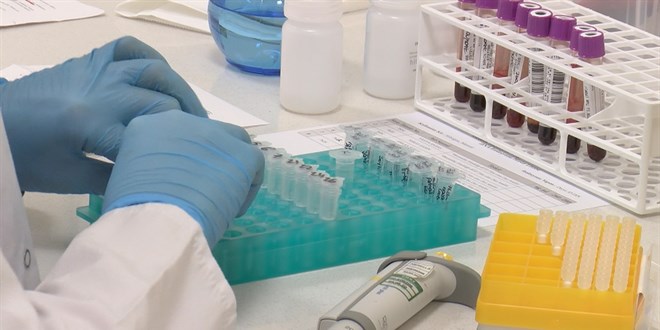 SMA testinin detaylarını uzmanları anlattı