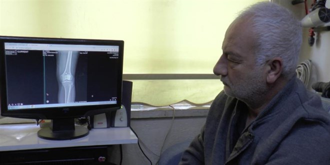 Diz kapağındaki mermi 13 gün sonra fark edildi