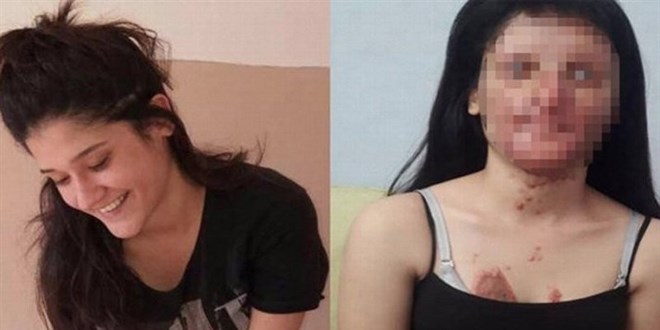 Yüzünü yakan kişiyle evlenen Berfin'in babası: Ben de sosyal medyadan duydum