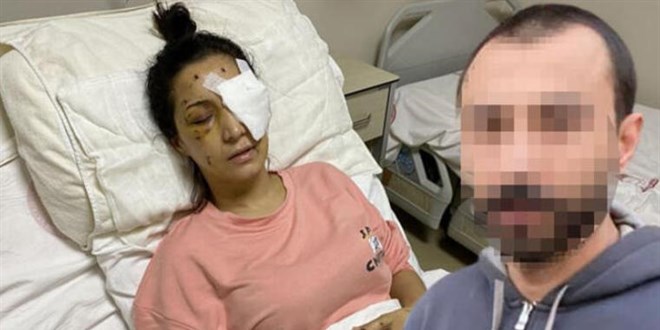 'Ağabey' demeyen yengesini 37 yerinden bıçaklayıp kör etti