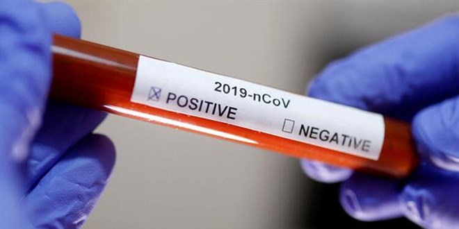 25 bin 401 kişinin Kovid-19 testi pozitif çıktı, 123 kişi hayatını kaybetti