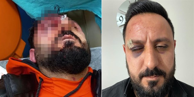 O soruyu sorunca öldüresiye dayak yedi! Komşuları üstünden geçti