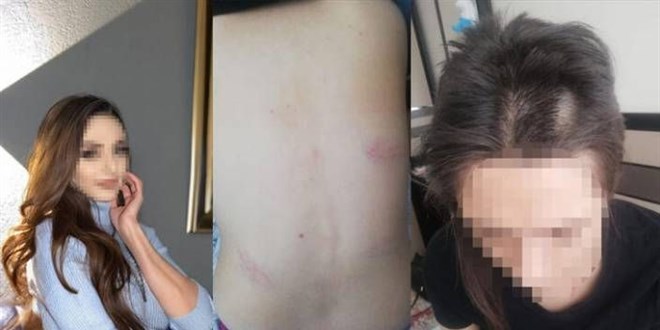 Konya'da genç kıza işkence iddiası: 3 kişi tutuklandı
