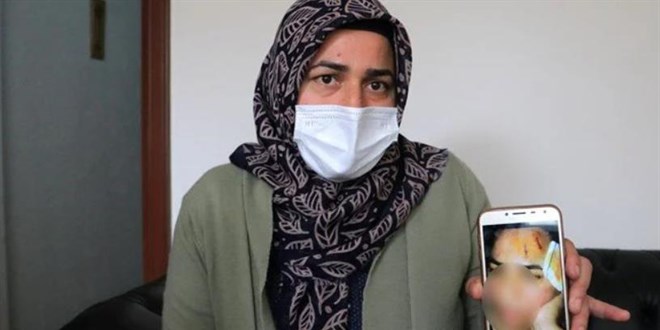 Komşusu yüzüne tencereyle vurdu, savcılık silah olarak kabul etti