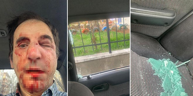 Profesöre 'burun ameliyatı' dayağına 28'er yıla kadar hapis talebi