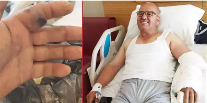 Elini sokan zehirli hayvanı poşete koyup hastaneye götürdü!