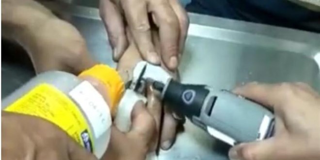 Kırıkkale'de çocuğun parmağına sıkışan metal somunu itfaiye çıkardı