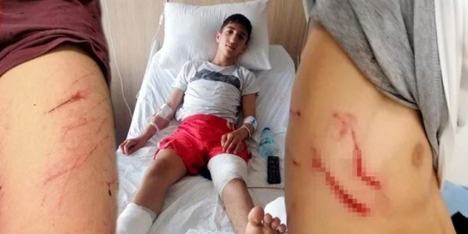Liseli Efe, okul önünde köpeklerin saldırısına uğradı