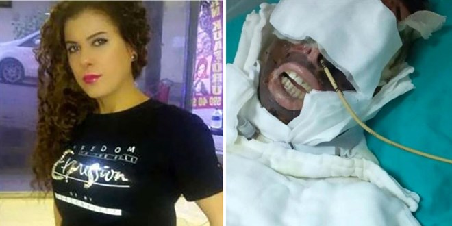 Kimyasalla yaktığı kadını yatağa mahkum eden sanık: Ben onu seviyorum