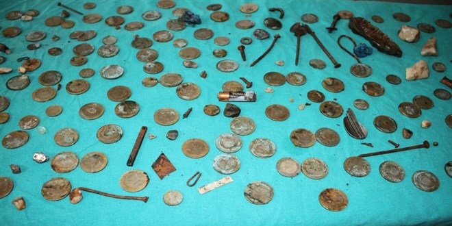 Midesinden 83 tane 1 lira çıktı