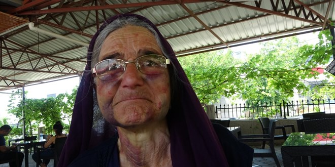 Kuzusunu sürüden almak isterken dayak yedi