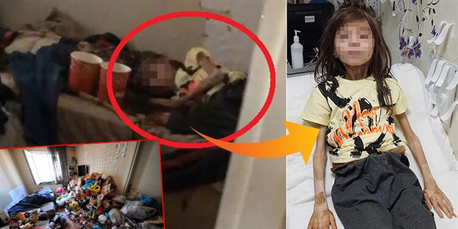 Çöp evde kilitli bulunan çocuk tedaviye alındı
