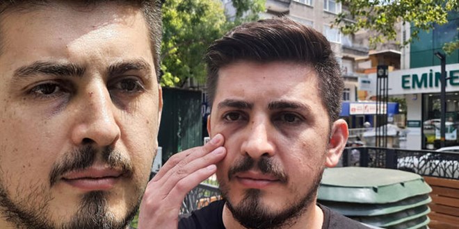 Hemşirenin burnunu kıran hasta yakını bu kez tutuklandı