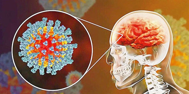 Kovid'in beyindeki etkileri geici