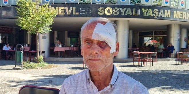 57 yıllık CHP üyesi parti binasında darp edildi