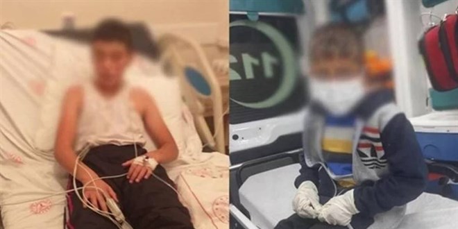 Kuduz olan çocuğun babası konuştu: Köpek ısırdığını bilseydik daha önce götürürdük