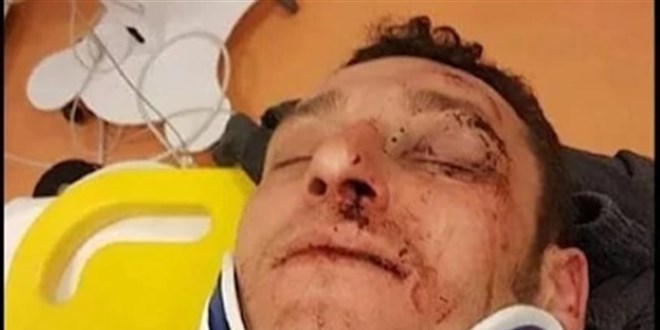 Seçimi kazanmak için rakibin seçmenini kaçırdılar