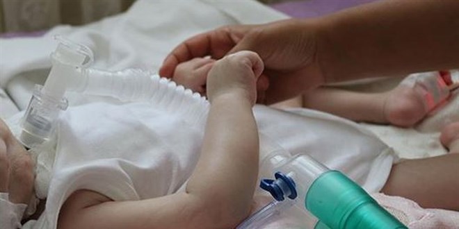Türkiye'de yaklaşık 70 bin MS hastası bulunuyor