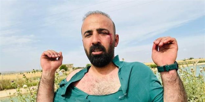Şanlıurfa'da seçim kavgası: YSP'li vekil dahil, 5 yaralı