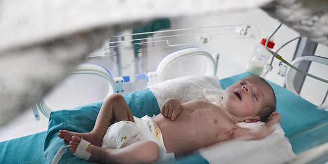 Nehir bebek '25 binde 1' görülen hastalığıyla mücadeleyi Türkiye'de kazandı