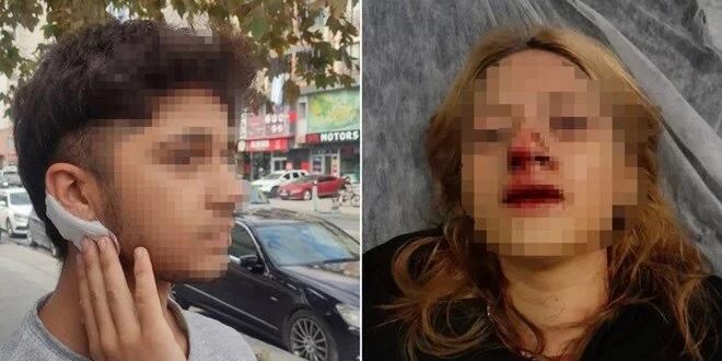 Kaldırım taşıyla tartıştıkları kızın dişlerini kıran 2 şüpheli tutuklandı