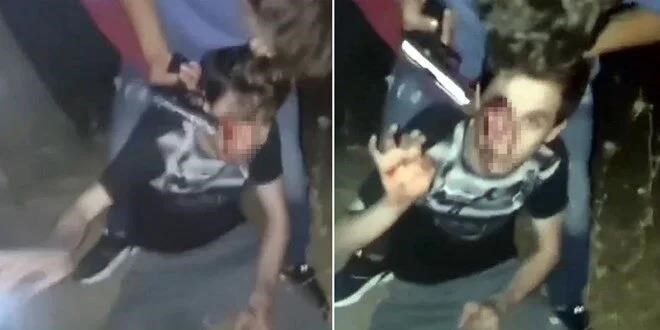 Engelli gencin başına silah dayayıp, döven 2 Suriyeli tutuklandı
