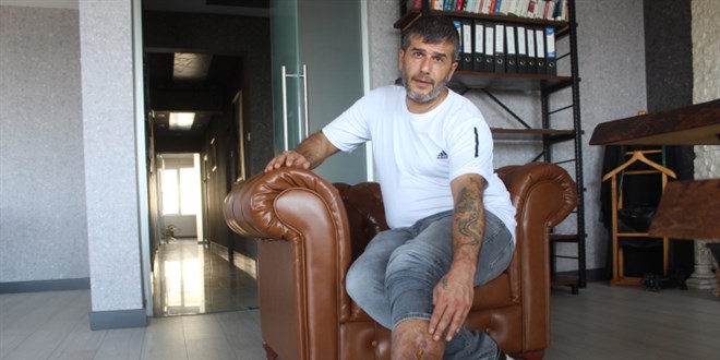 Ameliyatta bacağında unutulan bez parçasıyla 16 yıl yaşadı