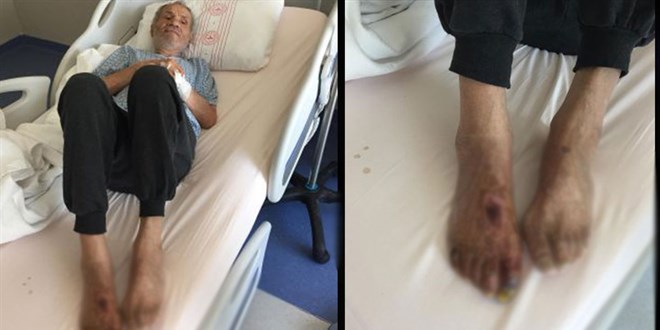 Ameliyat sonrası unutulan varis çorabı felakete yol açtı