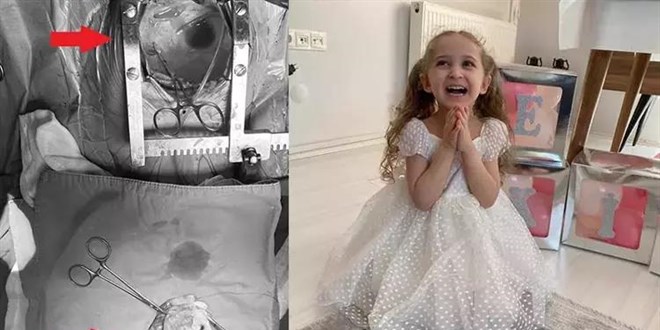 Minik kalbini 'söküp' tümörü temizleyip tekrar yerleştirdiler