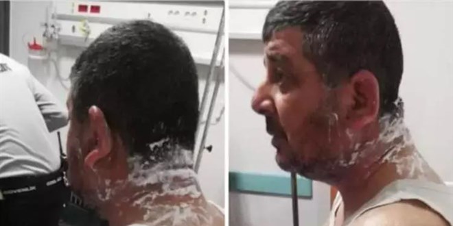 Ev sahibi tartıştığı kiracısına asitle saldırdı