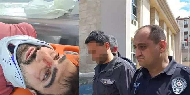 Engelli komşusunun burnunu kırdı, ardından sıcak su döktü