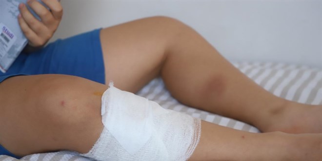 Ankara'da başıboş köpeklerin saldırdığı çocuk yaralandı
