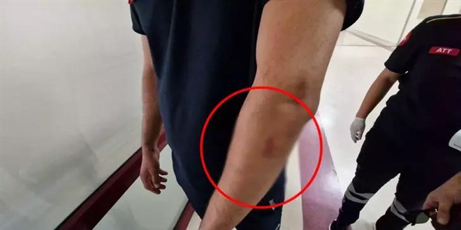 Hasta yakınları buz şişeleri ve bıçakla sağlık çalışanlarına saldırdı