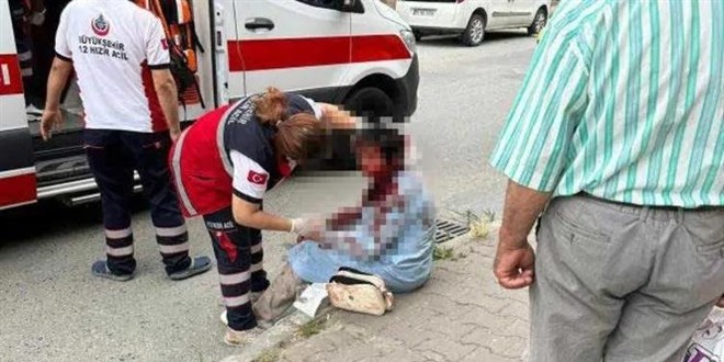 Köpek saldırısına uğradı, gözünden oldu Yargıtay üyesinin eşi ilk kez konuştu