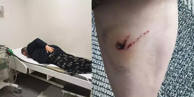 Köpeklerin saldırısında yaralandı, kaçarken beli kırıldı