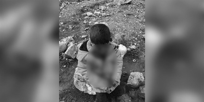 Başıboş köpeklerin saldırdığı çocuk ağır yaralandı