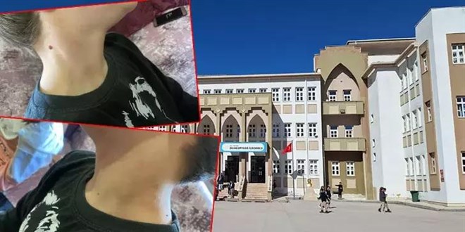 Bolu'da öğretmenin öğrencisini darp ettiği iddiasına soruşturma