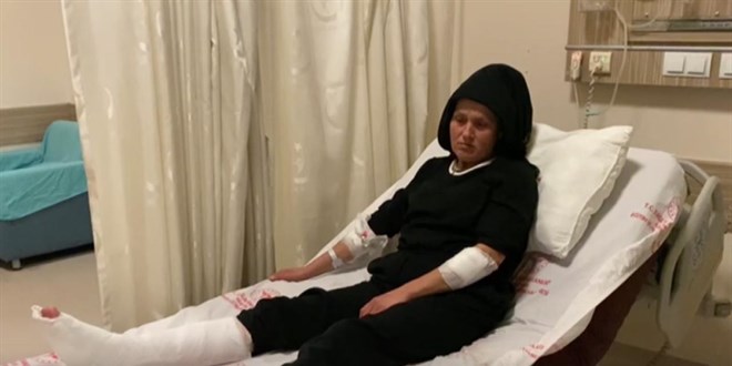 Sokakta yürüyen kadın 3 köpeğin saldırısına uğradı