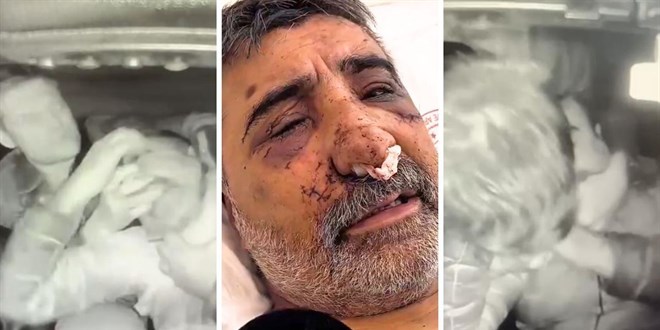İngiliz Boksörün Saldırısına Uğrayan Taksici Dehşeti Anlattı