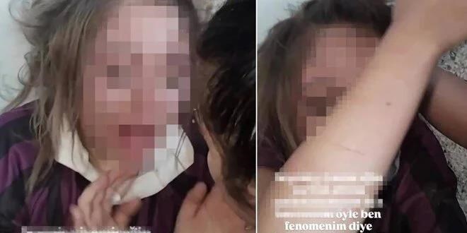 Genç kızı darbedip zorla özür dilettiler
