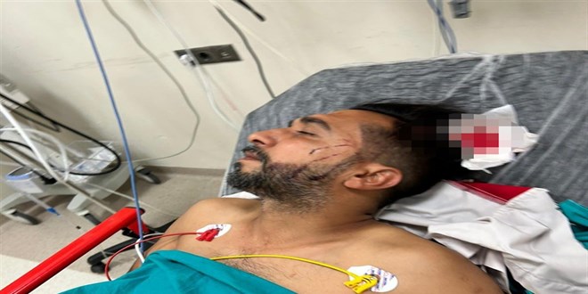 Döner yerken başına kurşun isabet etti