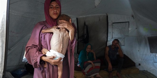 Gazze'de açlığın sembolü bebeğin doktoru, katil İsrail'in iddialarını yalanladı