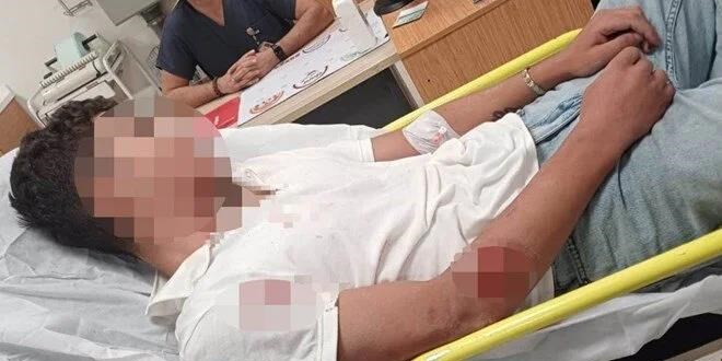 Ankara'da akran şiddeti: 14 yaşındaki çocuk hastanelik oldu