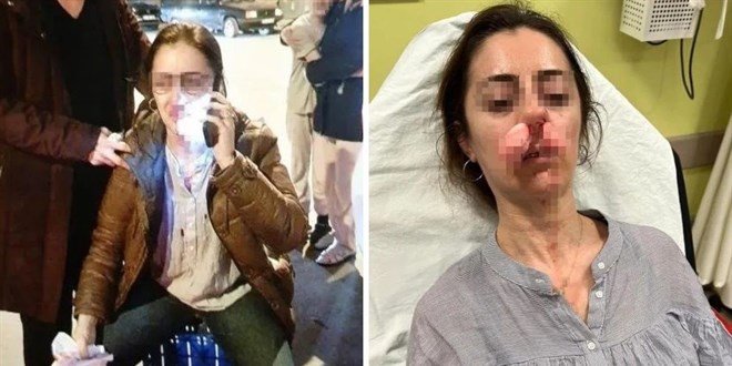 Kocasının arabasına benzettiği araçtan kadın inince saldırdı.. Otomobil kapısı silah sayıldı