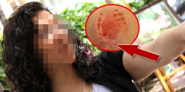 Faturası yüksek gelen öğretmen öğrenciyi ısırdı iddiası