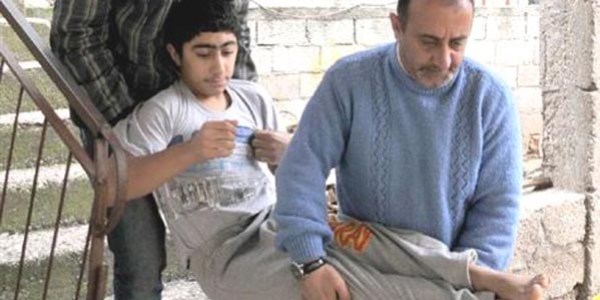 'Cam kemik' Bünyamin'e 3 farklı rapor
