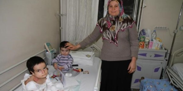 Mum gibi eriyen Canbek kardeşlerin tedavisine başlandı