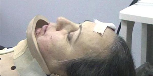 Kazada kalbi duran kadın kalp masajıyla kurtarıldı