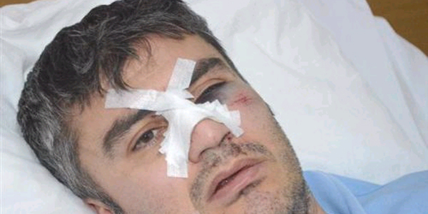 Doktorun burnunu kırdılar